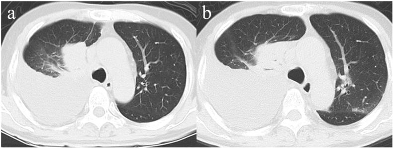 https://cdn.ncbi.nlm.nih.gov/pmc/blobs/5215/7892985/a59faca71354/gr1.jpg