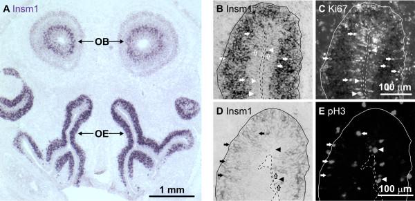 https://cdn.ncbi.nlm.nih.gov/pmc/blobs/521a/3057173/f6c43af6c72f/1749-8104-6-6-9.jpg