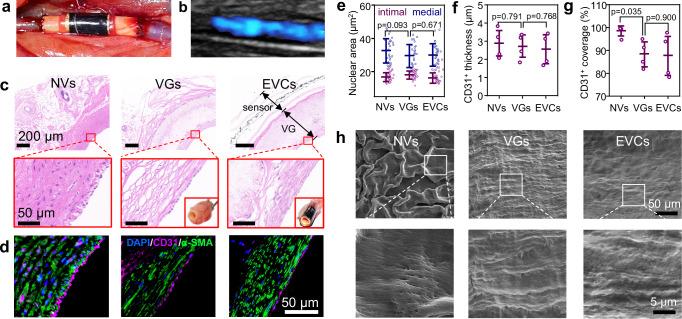 https://cdn.ncbi.nlm.nih.gov/pmc/blobs/521c/11920275/6c84b959cfff/41467_2025_58056_Fig5_HTML.jpg