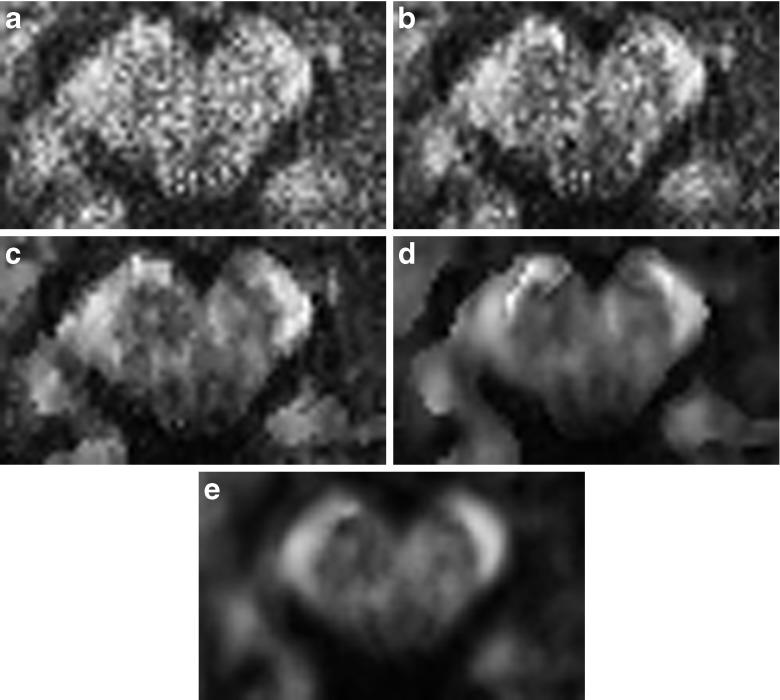 https://cdn.ncbi.nlm.nih.gov/pmc/blobs/521d/4303737/29e9a3e11228/12021_2014_9228_Fig7_HTML.jpg