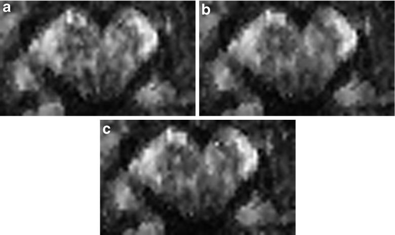 https://cdn.ncbi.nlm.nih.gov/pmc/blobs/521d/4303737/9bfa6c660bd9/12021_2014_9228_Fig8_HTML.jpg