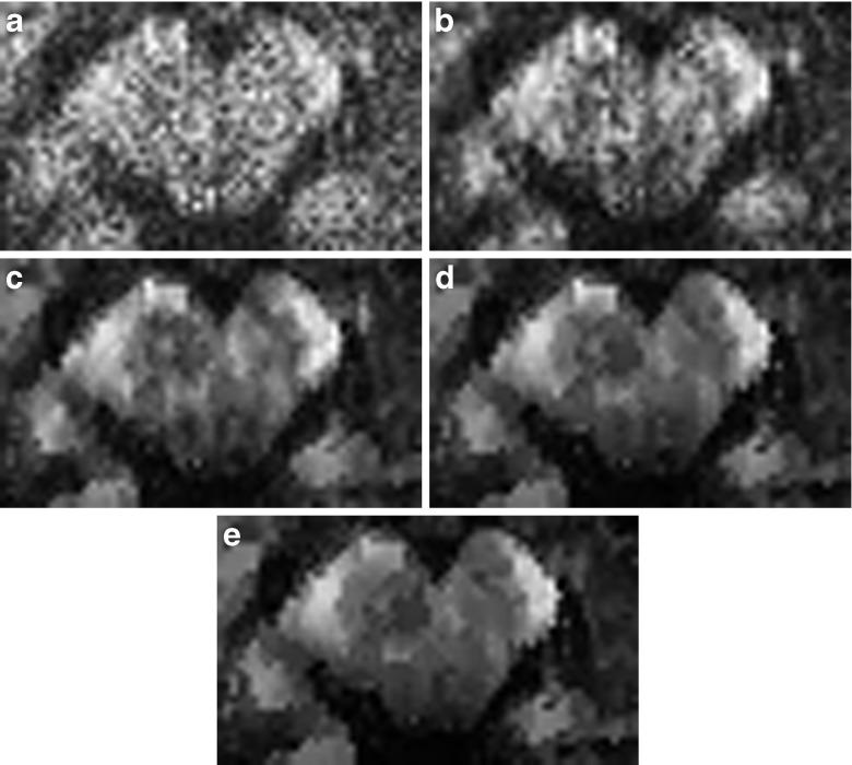 https://cdn.ncbi.nlm.nih.gov/pmc/blobs/521d/4303737/ea7a3ddf8c28/12021_2014_9228_Fig6_HTML.jpg