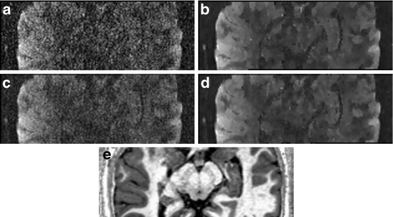 https://cdn.ncbi.nlm.nih.gov/pmc/blobs/521d/4303737/fdfedffda01b/12021_2014_9228_Fig4_HTML.jpg