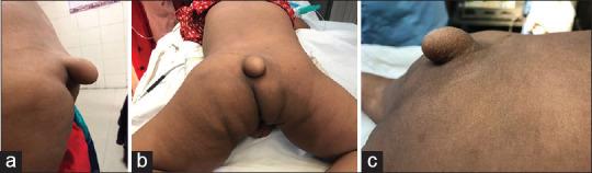 https://cdn.ncbi.nlm.nih.gov/pmc/blobs/521d/8109754/02d6d45bd7d5/AJPS-18-43-g003.jpg