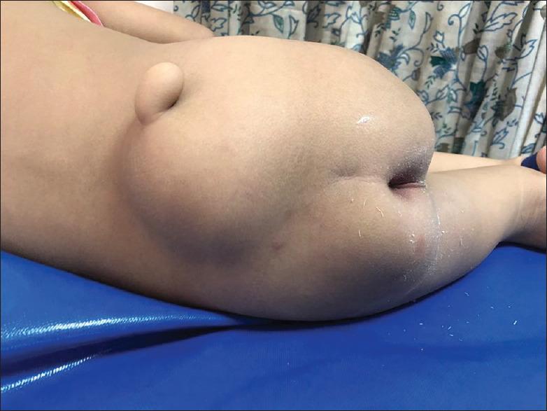 https://cdn.ncbi.nlm.nih.gov/pmc/blobs/521d/8109754/44cc2a717fed/AJPS-18-43-g004.jpg