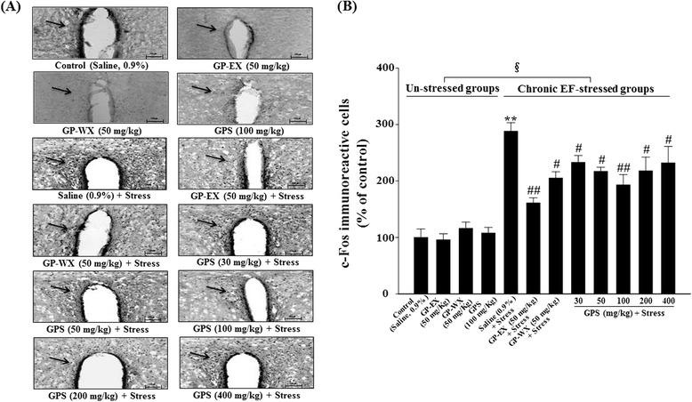 https://cdn.ncbi.nlm.nih.gov/pmc/blobs/521e/4570649/2c200ad192c1/12906_2015_856_Fig4_HTML.jpg