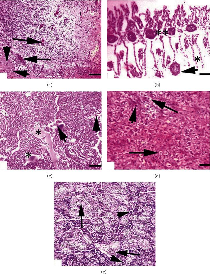 https://cdn.ncbi.nlm.nih.gov/pmc/blobs/5222/8816551/a0d8b278d952/OMCL2022-5450421.001.jpg