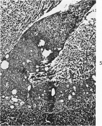 https://cdn.ncbi.nlm.nih.gov/pmc/blobs/5228/1965277/15f1fa3c3664/amjpathol00268-0110-e.jpg