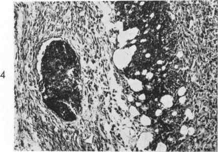 https://cdn.ncbi.nlm.nih.gov/pmc/blobs/5228/1965277/2a91491e6b9a/amjpathol00268-0110-d.jpg
