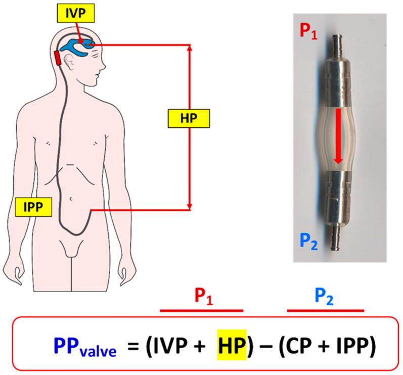 https://cdn.ncbi.nlm.nih.gov/pmc/blobs/522b/7999679/723b89c72bd0/jcm-10-01210-g003.jpg