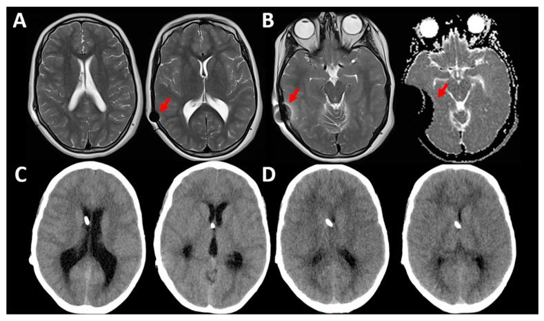 https://cdn.ncbi.nlm.nih.gov/pmc/blobs/522b/7999679/a3273ae1f359/jcm-10-01210-g008.jpg