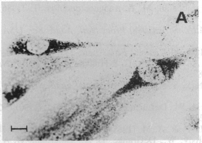 https://cdn.ncbi.nlm.nih.gov/pmc/blobs/522e/51033/67efde208978/pnas01054-0364-d.jpg