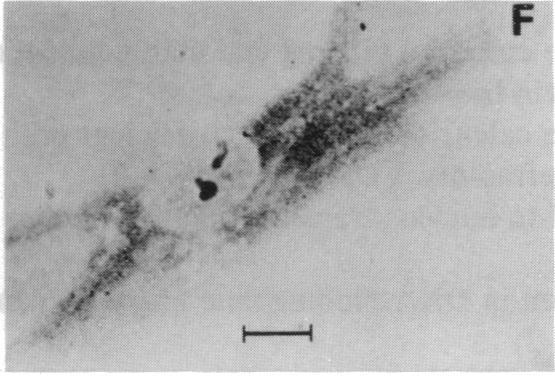 https://cdn.ncbi.nlm.nih.gov/pmc/blobs/522e/51033/9c1c550fcb98/pnas01054-0362-f.jpg
