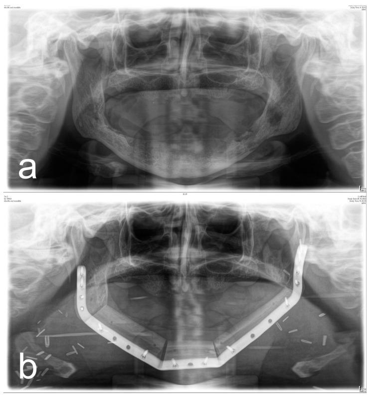 https://cdn.ncbi.nlm.nih.gov/pmc/blobs/5237/9914009/9b2446d78b72/diagnostics-13-00366-g003.jpg