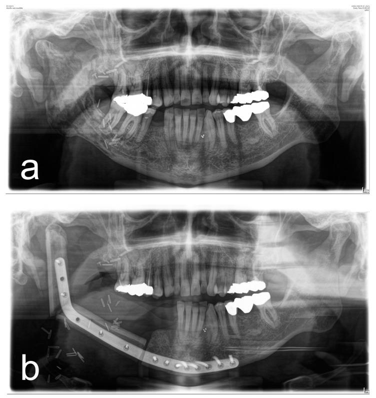 https://cdn.ncbi.nlm.nih.gov/pmc/blobs/5237/9914009/e65b106c3197/diagnostics-13-00366-g001.jpg
