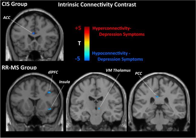 https://cdn.ncbi.nlm.nih.gov/pmc/blobs/5238/10338578/0de71a9d77cb/234_2023_3174_Fig4_HTML.jpg