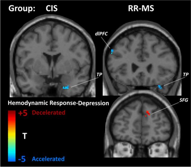 https://cdn.ncbi.nlm.nih.gov/pmc/blobs/5238/10338578/71786c393f6a/234_2023_3174_Fig5_HTML.jpg