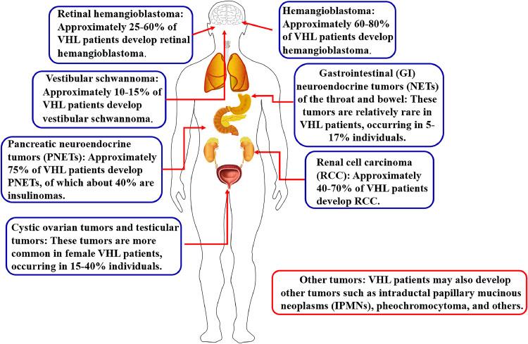 https://cdn.ncbi.nlm.nih.gov/pmc/blobs/5239/11617254/648bcb1e8655/gr1.jpg