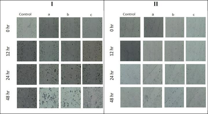https://cdn.ncbi.nlm.nih.gov/pmc/blobs/523a/11162737/c718e30815f5/APJCP-25-1457-g006.jpg