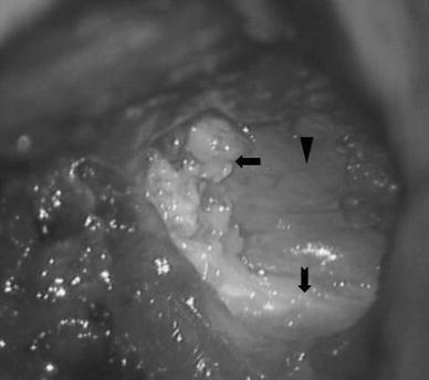 https://cdn.ncbi.nlm.nih.gov/pmc/blobs/523a/2896575/479cd27353e2/10195_2010_94_Fig1_HTML.jpg