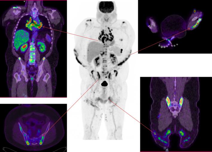 https://cdn.ncbi.nlm.nih.gov/pmc/blobs/523a/8995833/fd49c7d39e61/RCR2-10-e0949-g003.jpg