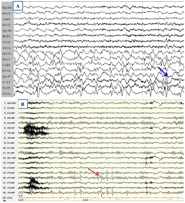 https://cdn.ncbi.nlm.nih.gov/pmc/blobs/523e/5542381/26854ef15174/gr1.jpg