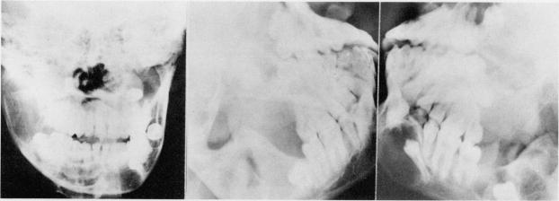 https://cdn.ncbi.nlm.nih.gov/pmc/blobs/5242/2552560/94cd4878a1fe/jnma00035-0094-a.jpg