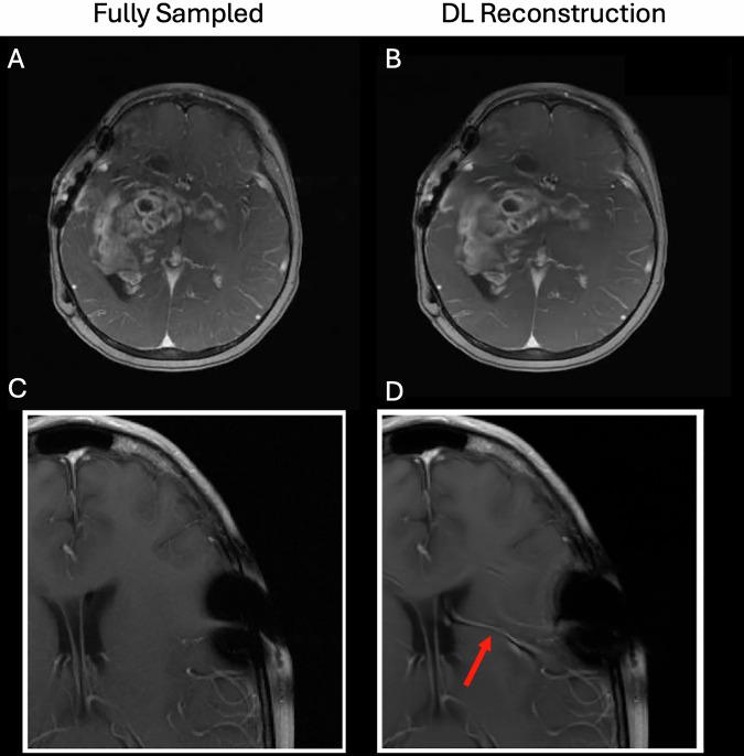 https://cdn.ncbi.nlm.nih.gov/pmc/blobs/5246/12118737/ef6f3b4d0c49/44303_2025_76_Fig1_HTML.jpg