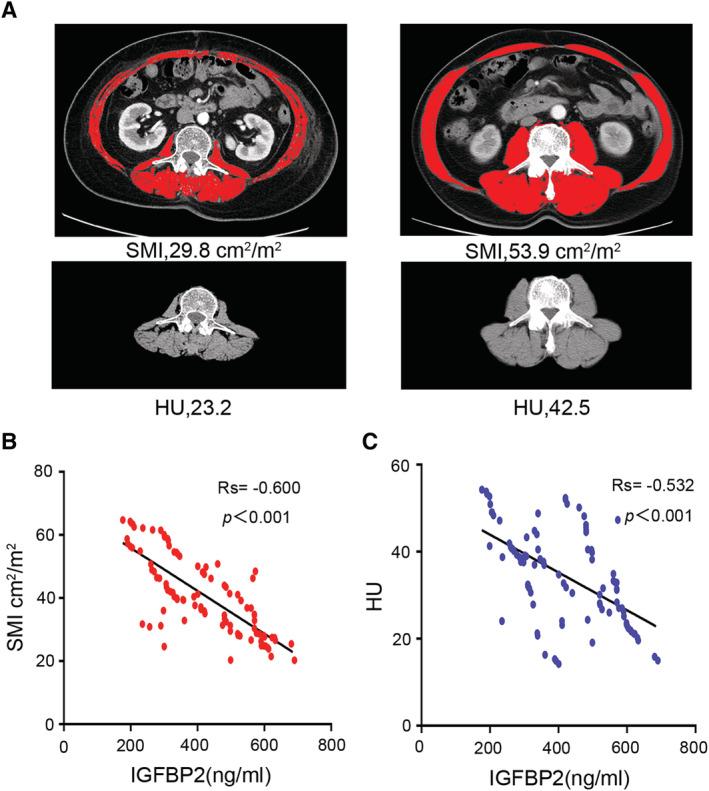 https://cdn.ncbi.nlm.nih.gov/pmc/blobs/5248/8200427/1e1c7086fd14/JCSM-12-704-g004.jpg