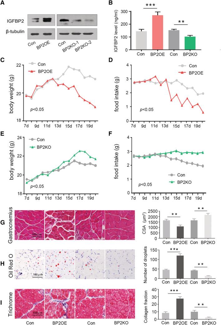 https://cdn.ncbi.nlm.nih.gov/pmc/blobs/5248/8200427/2c6e17b09b56/JCSM-12-704-g005.jpg