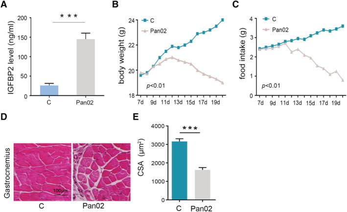 https://cdn.ncbi.nlm.nih.gov/pmc/blobs/5248/8200427/8e58b518a23b/JCSM-12-704-g002.jpg