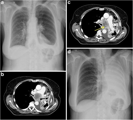 https://cdn.ncbi.nlm.nih.gov/pmc/blobs/5252/6108967/7eae65399c7e/13244_2018_605_Fig6_HTML.jpg