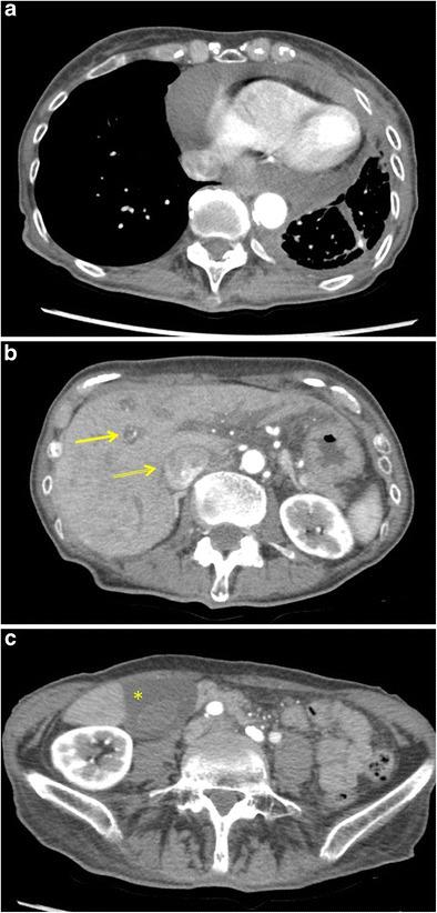https://cdn.ncbi.nlm.nih.gov/pmc/blobs/5252/6108967/c7605a8b0fad/13244_2018_605_Fig4_HTML.jpg