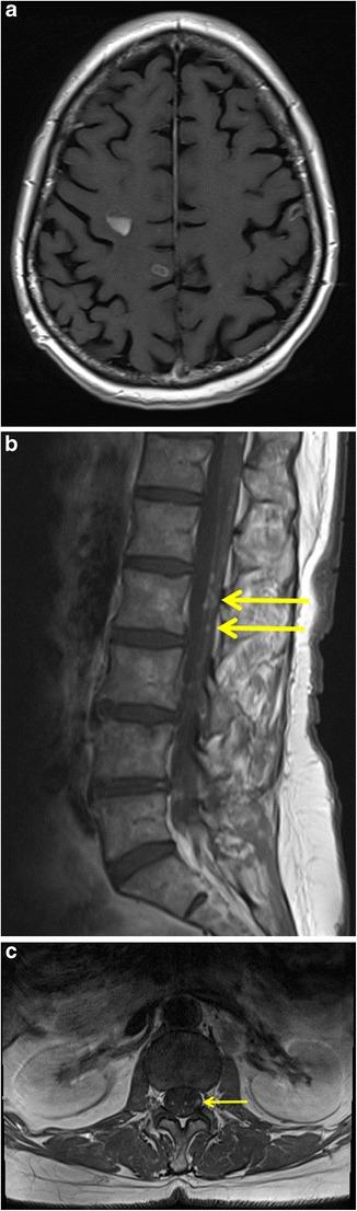 https://cdn.ncbi.nlm.nih.gov/pmc/blobs/5252/6108967/c7ed09c7658b/13244_2018_605_Fig10_HTML.jpg