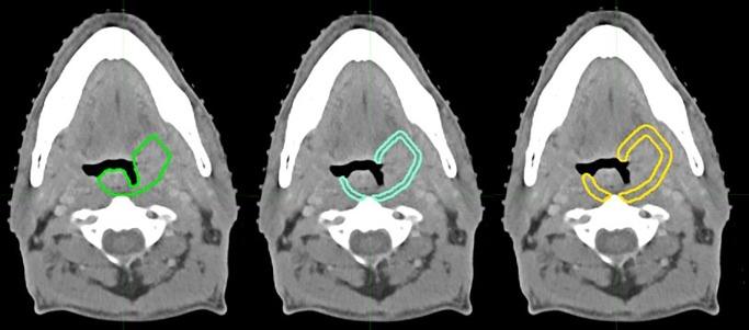 https://cdn.ncbi.nlm.nih.gov/pmc/blobs/5255/7244120/b6f78790165c/pone.0232639.g001.jpg