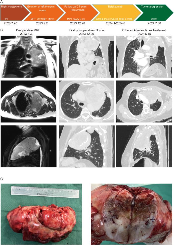 https://cdn.ncbi.nlm.nih.gov/pmc/blobs/5259/12034558/45401f5592ff/fonc-15-1535653-g001.jpg