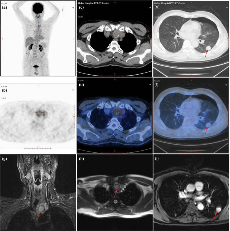 https://cdn.ncbi.nlm.nih.gov/pmc/blobs/5264/10199323/b35ddb315c50/j_biol-2022-0600-fig001.jpg