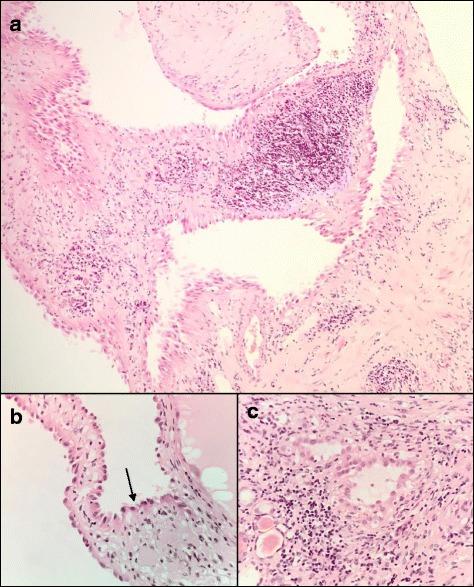 https://cdn.ncbi.nlm.nih.gov/pmc/blobs/5264/5530463/ac71ec6b3611/12881_2017_436_Fig2_HTML.jpg