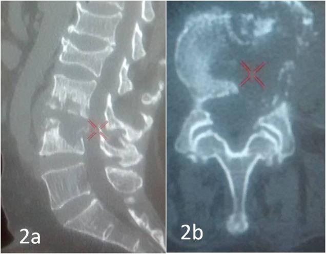 https://cdn.ncbi.nlm.nih.gov/pmc/blobs/5284/5608483/0595abb4857e/cureus-0009-00000001500-i02.jpg