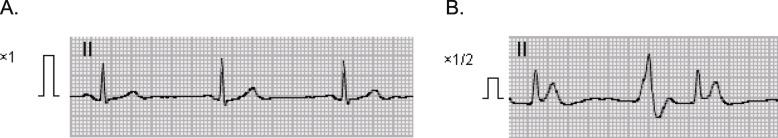 https://cdn.ncbi.nlm.nih.gov/pmc/blobs/5287/7721765/f810db0d9bf3/40981_2020_402_Fig1_HTML.jpg