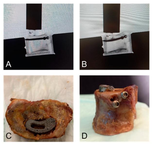 https://cdn.ncbi.nlm.nih.gov/pmc/blobs/5288/12024390/1c0485f25303/bioengineering-12-00337-g004.jpg