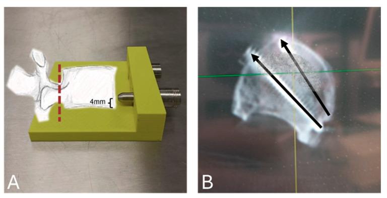 https://cdn.ncbi.nlm.nih.gov/pmc/blobs/5288/12024390/deed5070a577/bioengineering-12-00337-g001.jpg