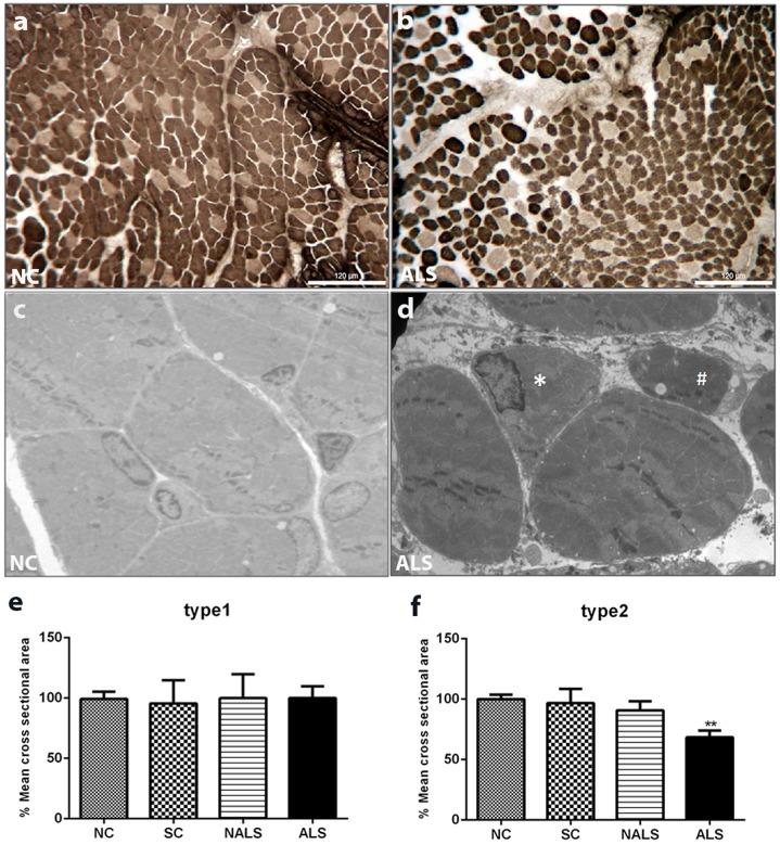 https://cdn.ncbi.nlm.nih.gov/pmc/blobs/5288/5963857/0cb406559b0a/dmm-11-031997-g1.jpg
