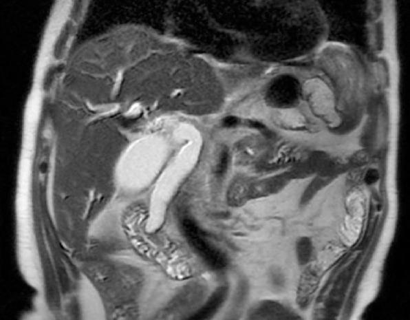 https://cdn.ncbi.nlm.nih.gov/pmc/blobs/5289/7881429/439aee322d01/NCI-8-97-g001.jpg