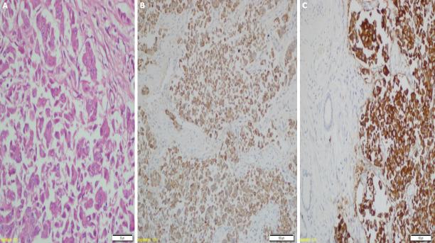 https://cdn.ncbi.nlm.nih.gov/pmc/blobs/5289/7881429/97cbb6a66cd2/NCI-8-97-g002.jpg