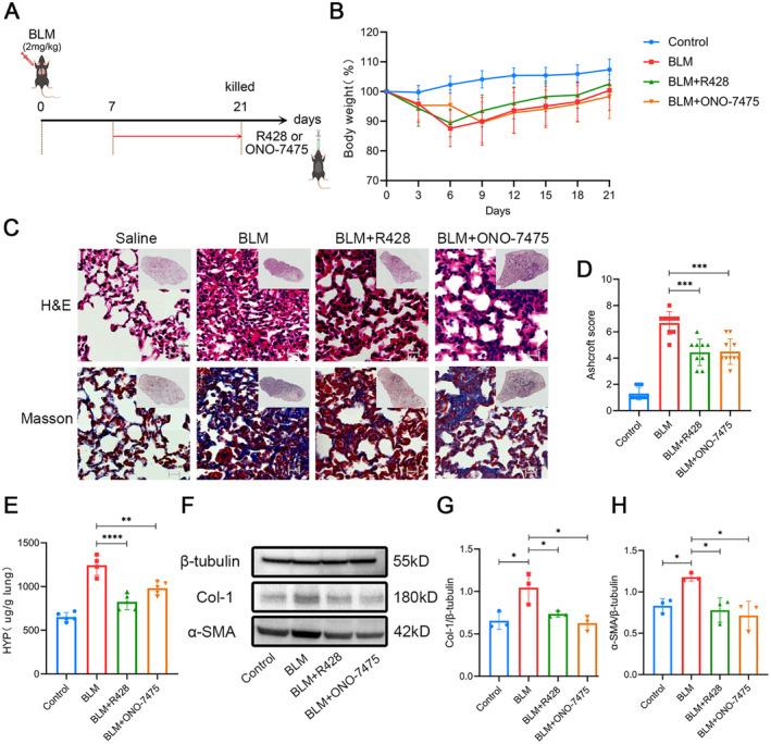 https://cdn.ncbi.nlm.nih.gov/pmc/blobs/5292/11710931/c3eb8d75262b/JCMM-29-e70321-g004.jpg