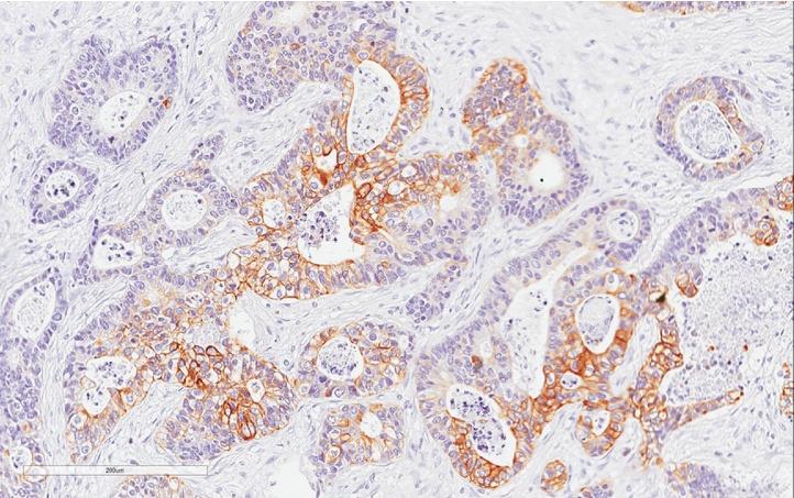 https://cdn.ncbi.nlm.nih.gov/pmc/blobs/5294/5192012/4b4c585cc327/gr2.jpg