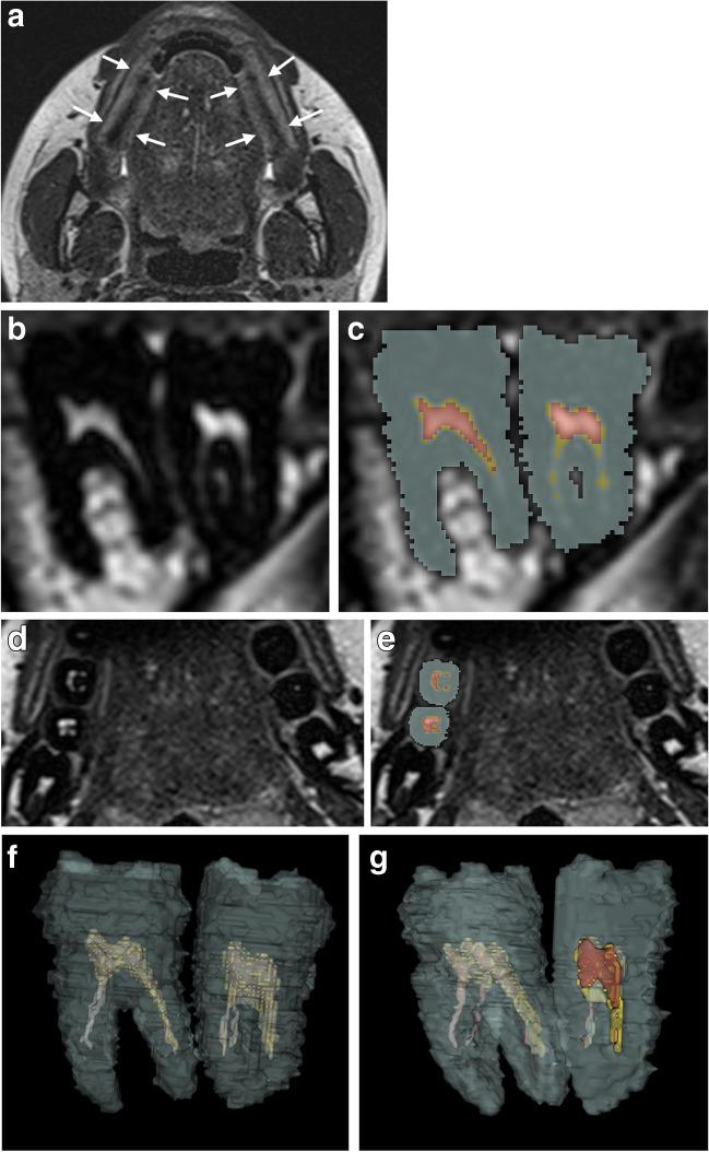 https://cdn.ncbi.nlm.nih.gov/pmc/blobs/5298/10421773/cfa142ff1c5d/414_2023_3055_Fig1_HTML.jpg