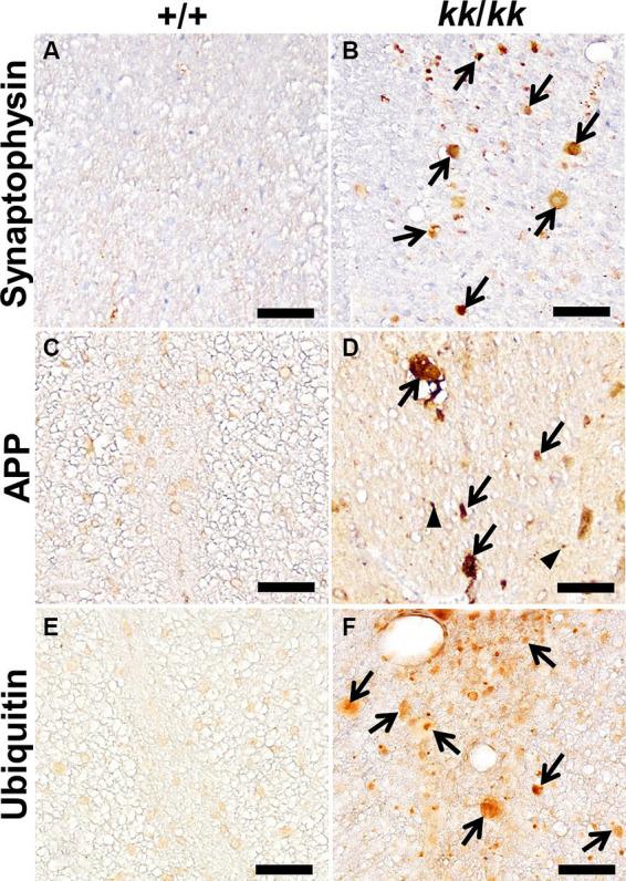https://cdn.ncbi.nlm.nih.gov/pmc/blobs/5299/10880117/58760d0b2aa9/fnins-18-1263724-g003.jpg