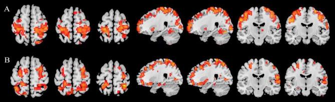 https://cdn.ncbi.nlm.nih.gov/pmc/blobs/529b/12083489/54addeb007e0/JPR-18-2379-g0001.jpg